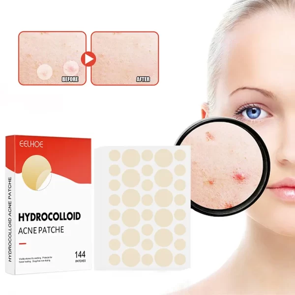ACNE PIMPLE PATCH STICKER